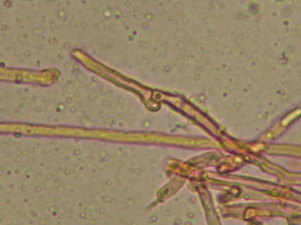 Cylindrobasidium laeve o evolvens ??(Cylindrobasidium laeve)